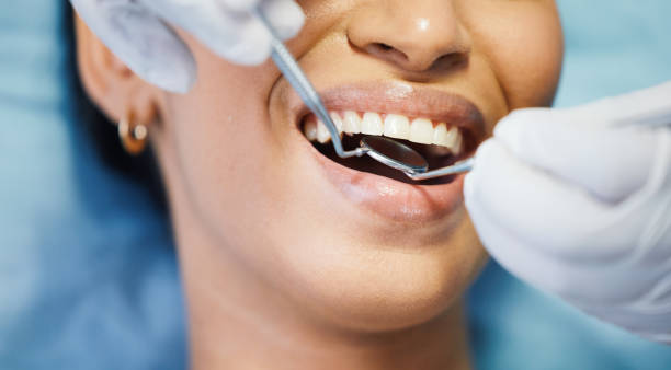 Best Emergency Treatment for Toothache in Island City, OR
