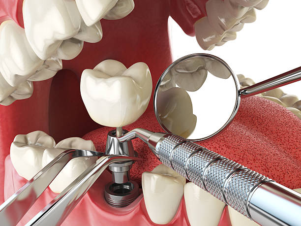 Best Emergency Dental Surgery in Island City, OR